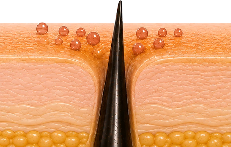 How Aging Odor Forms